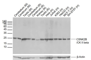 CSNK2B/CK II beta Recombinant Rabbit Monoclonal Antibody