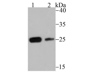 CSNK2B/CK II beta Recombinant Rabbit Monoclonal Antibody