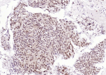 CSNK2B/CK II beta Recombinant Rabbit Monoclonal Antibody