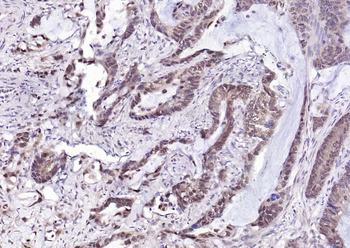 CSNK2B/CK II beta Recombinant Rabbit Monoclonal Antibody