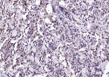 CSNK2B/CK II beta Recombinant Rabbit Monoclonal Antibody