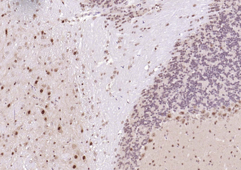 CSNK2B/CK II beta Recombinant Rabbit Monoclonal Antibody