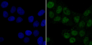 PDPK1 Recombinant Rabbit Monoclonal Antibody