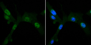PDPK1 Recombinant Rabbit Monoclonal Antibody