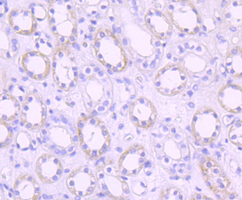 PDPK1 Recombinant Rabbit Monoclonal Antibody