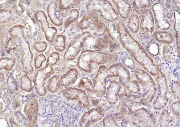 PDPK1 Recombinant Rabbit Monoclonal Antibody