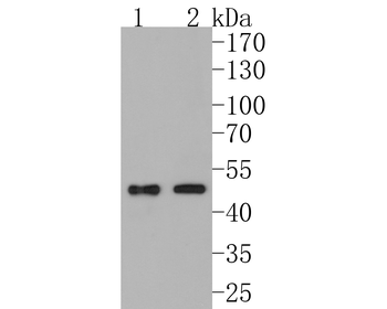 PDPK1 Recombinant Rabbit Monoclonal Antibody
