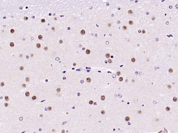 CAMK4 Recombinant Rabbit Monoclonal Antibody