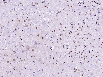 CAMK4 Recombinant Rabbit Monoclonal Antibody