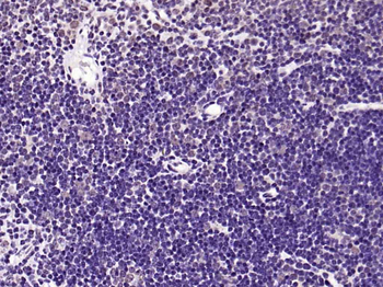 CAMK4 Recombinant Rabbit Monoclonal Antibody