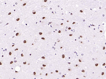 CAMK4 Recombinant Rabbit Monoclonal Antibody