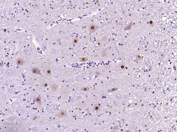 CAMK4 Recombinant Rabbit Monoclonal Antibody