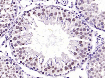 CAMK4 Recombinant Rabbit Monoclonal Antibody