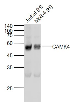 CAMK4 Recombinant Rabbit Monoclonal Antibody