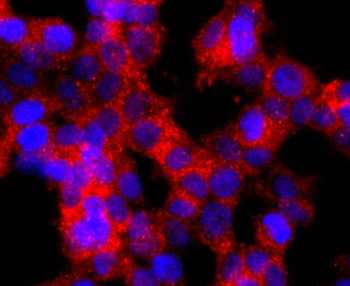 GLI1 Recombinant Rabbit Monoclonal Antibody