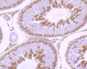 GLI1 Recombinant Rabbit Monoclonal Antibody