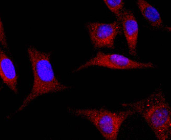 GLI1 Recombinant Rabbit Monoclonal Antibody