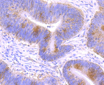 GCLM Recombinant Rabbit Monoclonal Antibody