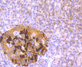 GCLM Recombinant Rabbit Monoclonal Antibody