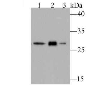 GCLM Recombinant Rabbit Monoclonal Antibody