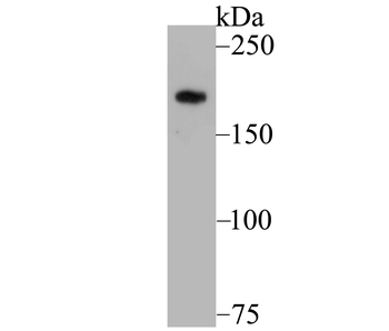Gli3 Recombinant Rabbit Monoclonal Antibody