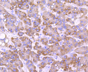 CYP2E1 Recombinant Rabbit Monoclonal Antibody