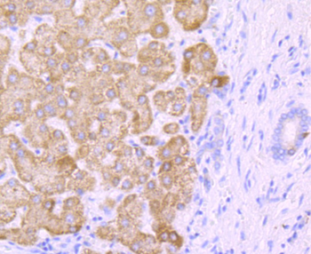 CYP2E1 Recombinant Rabbit Monoclonal Antibody