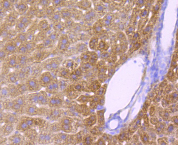 CYP2E1 Recombinant Rabbit Monoclonal Antibody