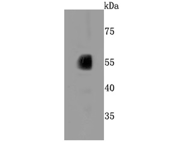 CYP2E1 Recombinant Rabbit Monoclonal Antibody