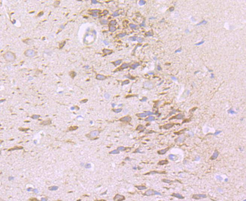 NG2 Recombinant Rabbit Monoclonal Antibody