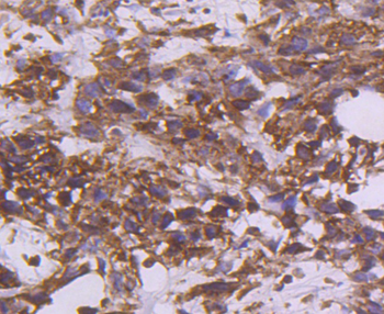 Tissue factor Recombinant Rabbit Monoclonal Antibody