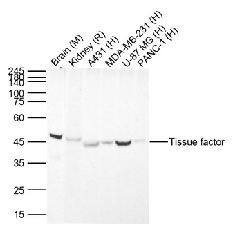Tissue factor Recombinant Rabbit Monoclonal Antibody