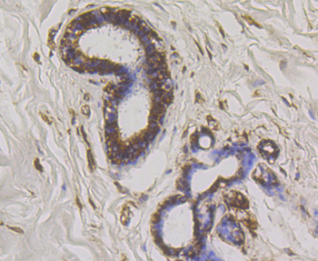 WNK1 Recombinant Rabbit Monoclonal Antibody