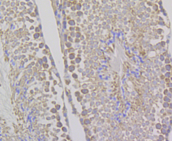 WNK1 Recombinant Rabbit Monoclonal Antibody