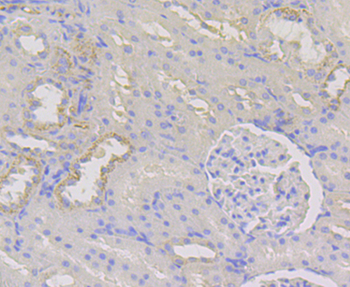 WNK1 Recombinant Rabbit Monoclonal Antibody