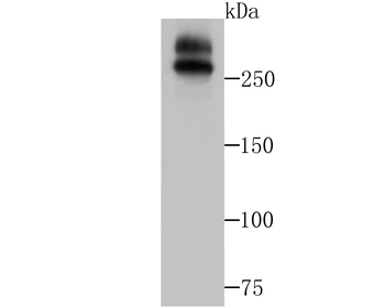 WNK1 Recombinant Rabbit Monoclonal Antibody