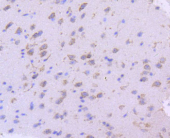 SGK1 Recombinant Rabbit Monoclonal Antibody