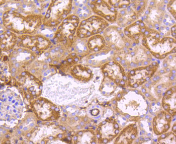 SGK1 Recombinant Rabbit Monoclonal Antibody