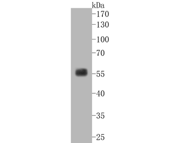 SGK1 Recombinant Rabbit Monoclonal Antibody