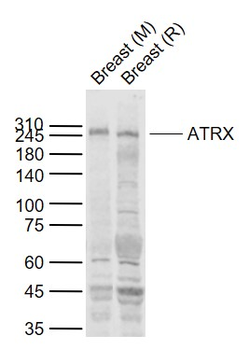 ATRX Rabbit Polyclonal Antibody