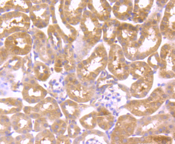 Wnt2b Recombinant Rabbit Monoclonal Antibody