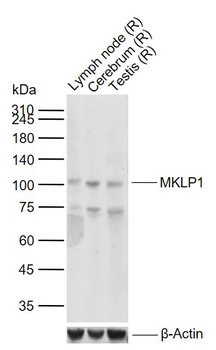 MKLP1 Recombinant Rabbit Monoclonal Antibody