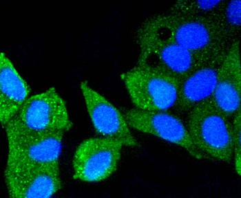 ATM Recombinant Rabbit Monoclonal Antibody