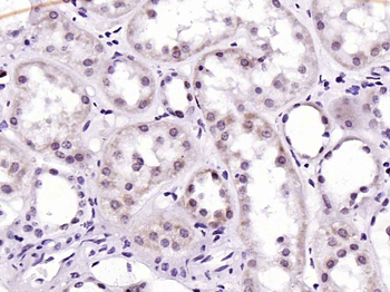 ATM Recombinant Rabbit Monoclonal Antibody