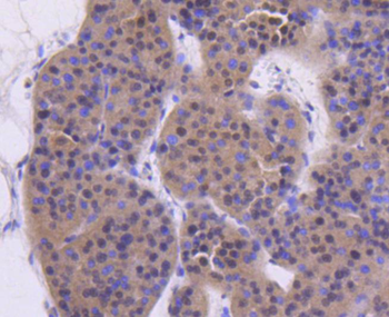 ATM Recombinant Rabbit Monoclonal Antibody