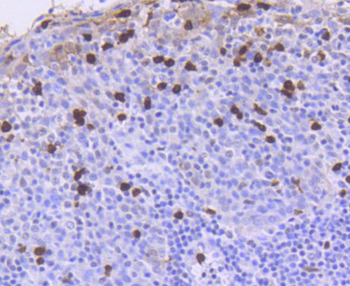 ATM Recombinant Rabbit Monoclonal Antibody