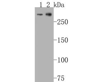 ATM Recombinant Rabbit Monoclonal Antibody