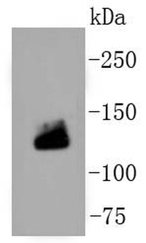 Collagen I Recombinant Rabbit Monoclonal Antibody