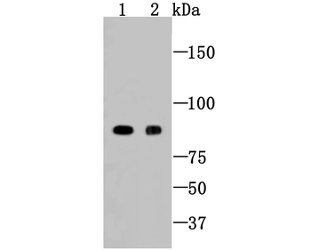 Cleaved PARP Recombinant Rabbit Monoclonal Antibody