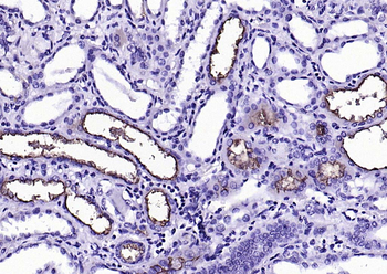 ACE2 Mouse Monoclonal Antibody